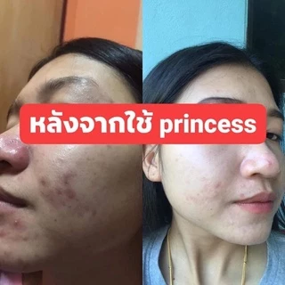 PRINCESS ครีมขมิ้นปริ้นเซส แท้ 100% [รับตรงจากแบรนด์ ] มากดใช้ส่วนลดหน้าไลฟ์ จัดหนักลดเยอะ