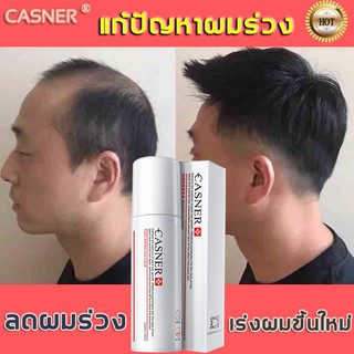 CASNER น้ำยาปลูกผม ปลูกผม น้ำยาเร่งผมยาว เซรั่มปลูกผม น้ำยาปลูกผม เร่งผมขึ้นใหม่ เซรั่มบำรุงผม รักษาผม รักษาผมร่วง สเปรย