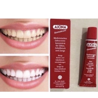 ของแท้100% AJONA TOOTHPASTE ยาสีฟันอโจนา ลดกลิ่นปากและหินปูนขนาด25ml. ขนาดปกติExpiry:11/2024