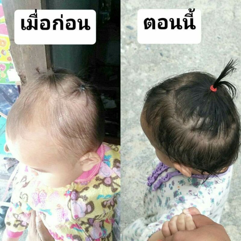 แชมพู่หมีม่วง ACHI HERB