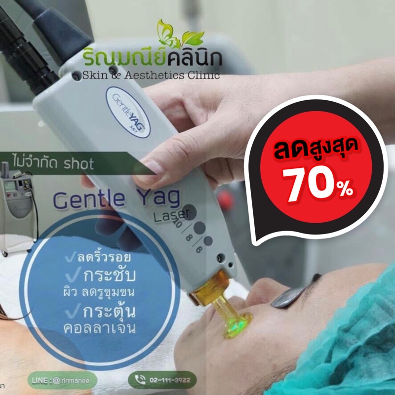 เลเซอร์หน้า Gentle Yag Reju เลเซอร์ Long Pulse Nd:YAG ปรับสภาพผิวหน้าและคอให้เรียบเนียน กระตุ้นคอลลา
