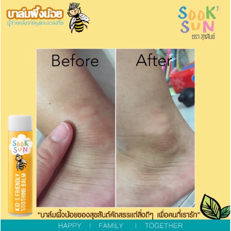 บาล์มผึ้งน้อยสุขสันต์ ทาหลังยุงหรือแมลงกัด ลดผดผื่นคัน บำรุงผิว ออร์แกนิค (สูตรoriginal) ลดคัน ลดบวมได้เร็ว ขนาด 5 ml