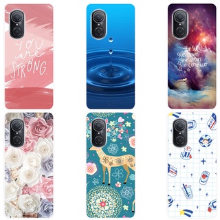 เคส Huawei Nova 9 Se เคสซิลิโคน น่ารัก การ์ตูน ฝาหลัง Huawei Nova 9 Se 9Se เคสนิ่ม TPU