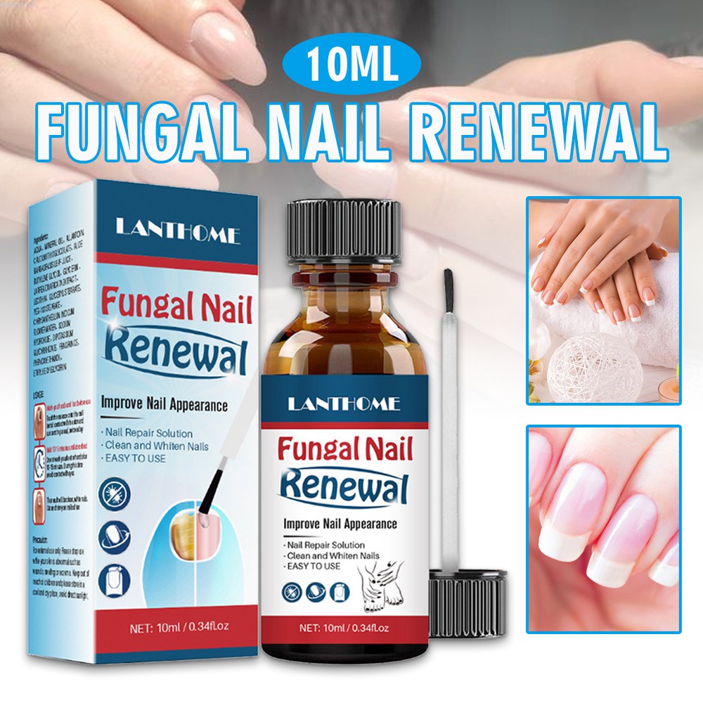 Crazyi 10ml Fungal Nail Renewal Extra Strength Nail Fungus Treatment Liquid