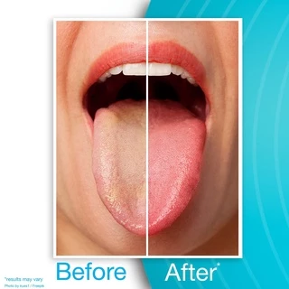 drTung's Tongue Cleaner ที่กวาดลิ้น ขูดลิ้น ทำความสะอาดลิ้น แปรงลิ้น Dr.Tung แปรงขูดลิ้น (คละสี)