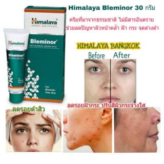 Himalaya Bleminor 30 ml ลดรอยดำ ลดรอยสิว