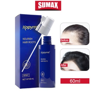 SUMAX โลชั่นเร่งผมยาว Reagain ป้องกันผมร่วง ผมมัน ผมชี้ฟู บำรุงรากผม