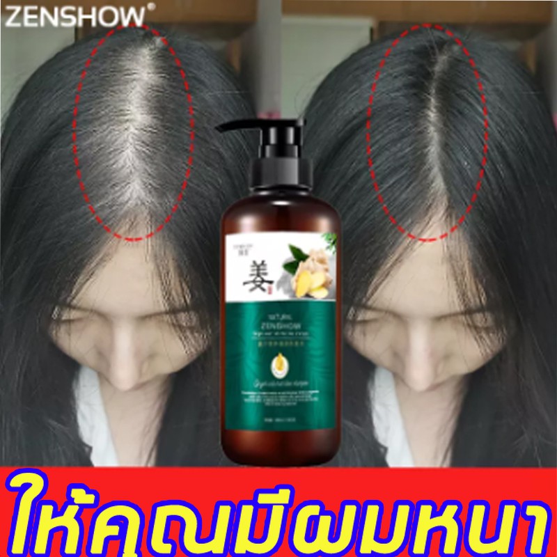 ZENSHOW แชมพูปลูกผมดก ผมแข็งแรงป้องกันผมร่วง ยาสระผมแก้ร่วง แชมพูเร่งผมยาว ทรีทเมนต์ผมล่วง ปลูกผม เร