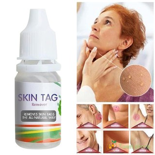 All Natural Skin Tag Warts Removal Liquid Foot Corn Removal Skin Care