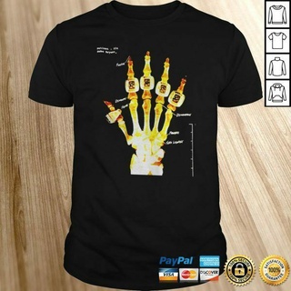 เสื้อยืดลําลอง แขนสั้น พิมพ์ลาย Kobe Hand Xray ทรงโอเวอร์ไซซ์ สําหรับผู้ชาย