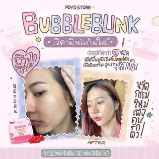 Bubble Blink  “วิตามินแก้มใส” 1 ซอง มี 15 เม็ด💖💌