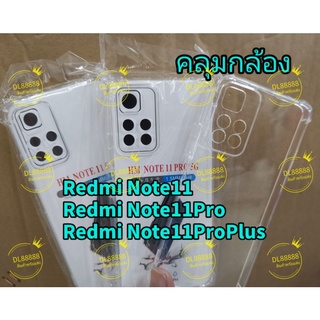 Redmi Note11s✨พร้​อมส่งใน🇹🇭✨เคสใสกันกระแทกคลุมกล้องFor Redmi Note 11 / Redmi Note 11 Pro Plus / Note11Pro / Redmi Note11