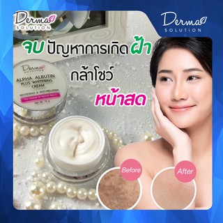 ครีมทาฝ้า Alpha Arbutin Plus Whitening Cream (15g) ครีมทาหน้า ขาวใส ครีมบำรุงหน้า ครีมฝ้ากระ ครีมหน้าขาว ฝ้ากระ