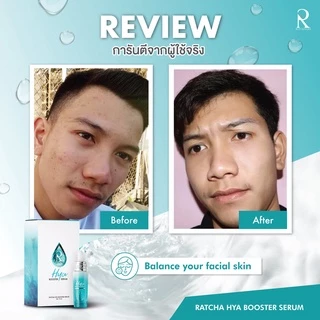ไฮยาบูสเตอร์ เซรั่ม เซรั่มน้องฉัตร เซรั่มไฮยาน้องฉัตร Ratcha Hya Booster Serum 15ml.