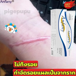 Anfany 30g ครีมลดรอยแผลเป็น ครีมทาแผลเป็น รักษารอยแผลเป็น ทาแผลเป็น ครีมแผลเป็น แผลผ่าตัด ครีมทารอยแผลเป็น ครีมลบแผลเป็น