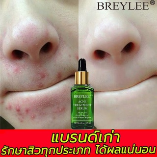 ของแท้ BREYLEE เซรั่มบำรุงผิวหน้า ป้องกันสิว17 มล ลดรอยแผลเป็นจากสิว ครีมแต้มสิว ครีมลดสิว ครีมรักษาสิว ครีมกำจัดสิว