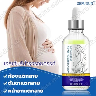 【บอกลาท้องลาย กระชับผิว】✅ออยทารอยแตกลาย 30ml ✅ครีมลดลอยเเตก ครีมทารอยแตกลาย ครีมทาท้องลาย ครีมทาขาแตกลาย ครีมลดรอยแตกลาย