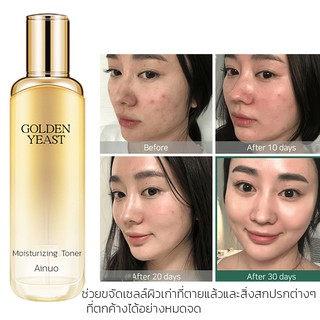 A620 GOLD YEAST MOISTURIZING TONER  โทนเนอร์ สูตรปราศจากแอลกอฮอล์ า ช่วยขจัดเซลล์ผิวเก่าที่ตายแล้วและสิ่งสกปรกต่างๆ