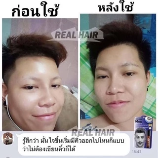 ของแท้!!! Real Hair- เซรั่มปลูกผม คิ้ว หนวด จอน -(สูตรหัวเชื้อ) ใช้ได้ทั้ง ช ญ