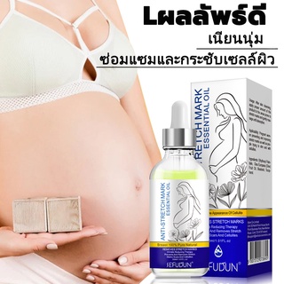 【บอกลาท้องลาย กระชับผิว】✅ออยทารอยแตกลาย 30ml ✅ครีมลดลอยเเตก ครีมทารอยแตกลาย ครีมทาท้องลาย ครีมทาขาแตกลาย ครีมลดรอยแตกลาย