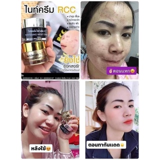 RCCครีมหน้าใสไร้สิวฝ้า‼️จะผิวโทนไหนก็ใช้ดีจ้าาา 📌 ✅สิว ✅ริ้วลอย  📌 ✅ฝ้า ✅กระ 📌 ✅บำรุง