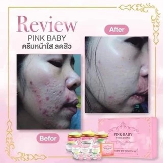 [ลดทันที 50฿ โค้ดDETSEP199] Pink Baby Cream ครีมพิ้งค์เบบี้ แบบชุด แบบแยก