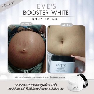 ครีมทาท้องลาย EVES "ครีมบูสเตอร์อีฟส์" ครีมลดรอยแตกลาย "Booster white body cream" ป้องกันรอยแตกลาย ครีมคนท้องใช้ได้100%