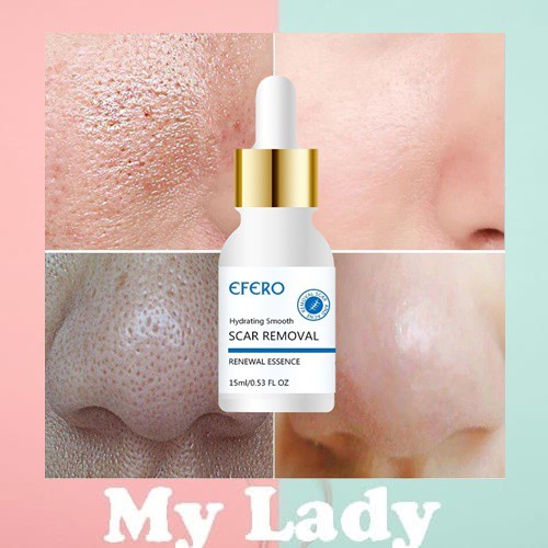 EFERO เอสเซนส์ลดสิว code037 Efero Acne removal Face Cream Repair Essence Whitening Cream Black dot Spotเซรั่มดูแลผิวหน้า