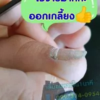 ตัดเล็บขบ​ แยกชิ้น หลายขนาด ตัดง่ายไม่เจ็บของแท้