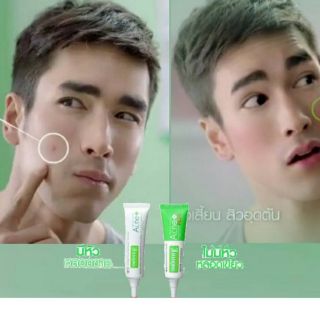 SMOOTH E ACNE  PLUS10G HYDROGEL 7G ครีมแต้มสิว 2 สูตร