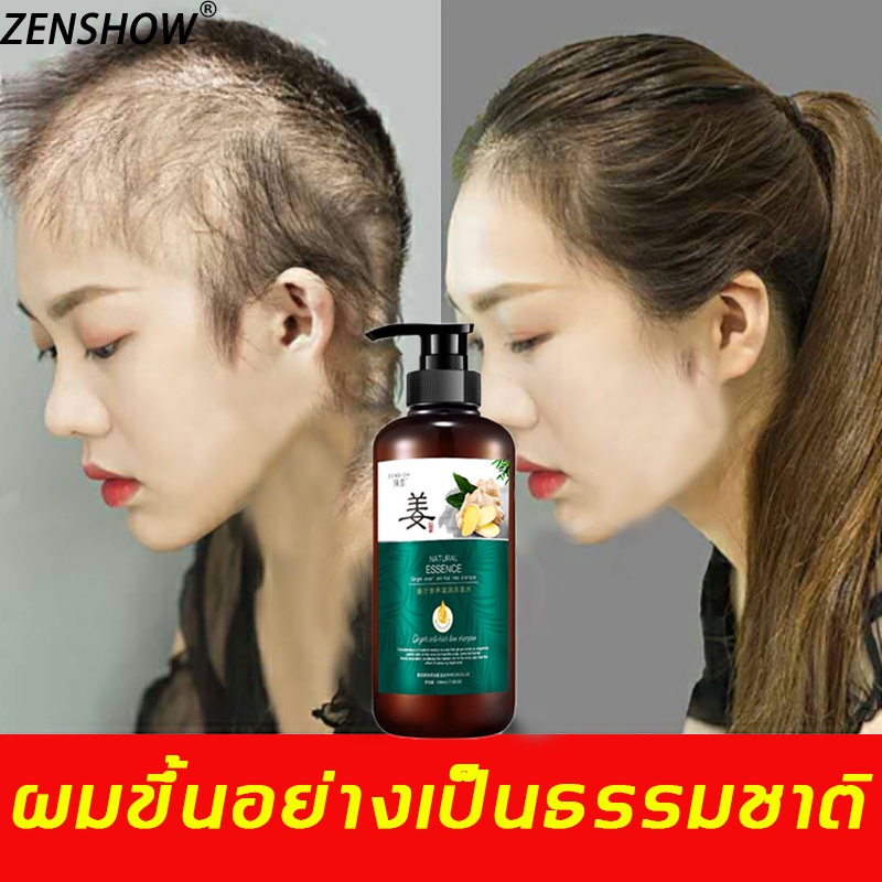 ของแท้100%ZENSHOWแชมพูขิง แชมพูแก้ผมร่วง500mlะ(แชมพูขิงเพียว ยาสระผมแก้ร่วง ผมร่วงผมบาง แชมพูปลูกผม บำรุงหนังศรีษะ )