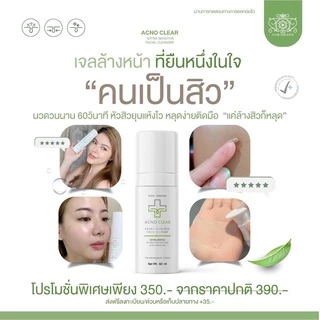 AcnoClear ขนาดใหม่ 60ml🔥🔥 เจลล้างหน้าลดสิว