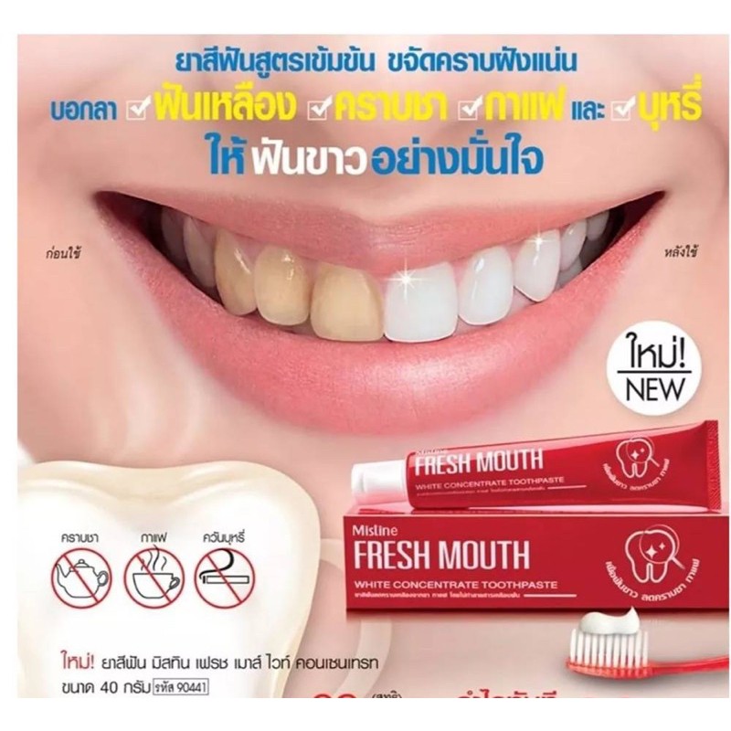 EXP:10/22 อ่านก่อนสั่ง ยาสีฟันมิสทิน เฟรซ เมาส์ คอนเซนเทรท ขนาด40 กรัม