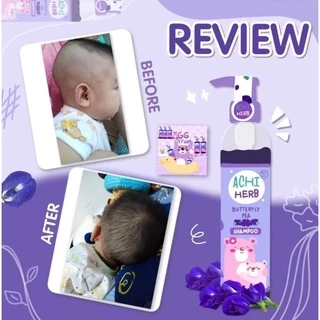 Achi Herb ออแกนิค แชมพูเร่งผมยาวสำหรับเด็ก และผู้ใหญ่ ผมยาวไวx3 ใช้ได้ตั้งแต่แรกเกิด