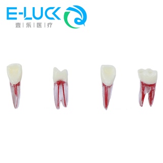 เครื่องมือทันตกรรม Endodontic Tooth 1 ชิ้นพร้อมรากสีสําหรับการศึกษา