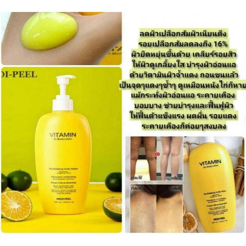 Medi Peel Vitamin Body Lotion 400 ml. โลชั่นลดสิวอักเสบ ลดรอยสิว  ผิวเกลี้ยงใส ลดผิวเปลือกส้ม | Shopee Thailand