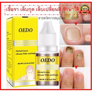 OEDO เซรั่มสมุนไพรAntibacterial Nail Treatments ด้วยสารสกัดน้ำมันสมุไพร ยับยั้งเชื้อรา บำรุงเล็บอย่างล้ำลึก 10 มล.