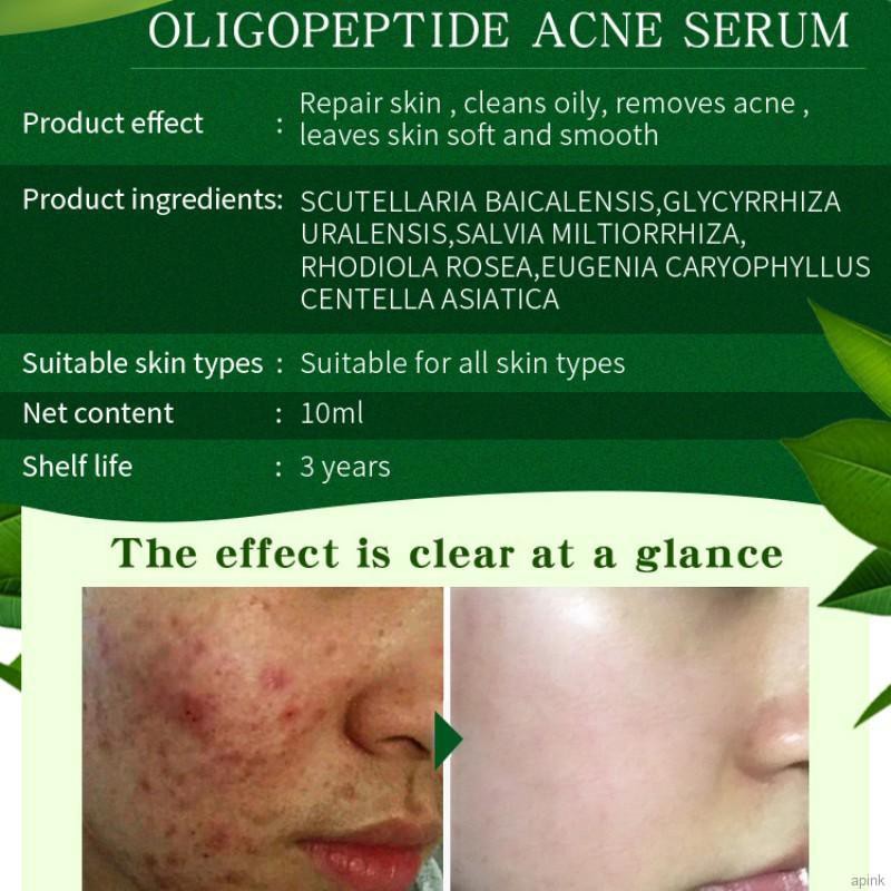 oligopeptide acne serum