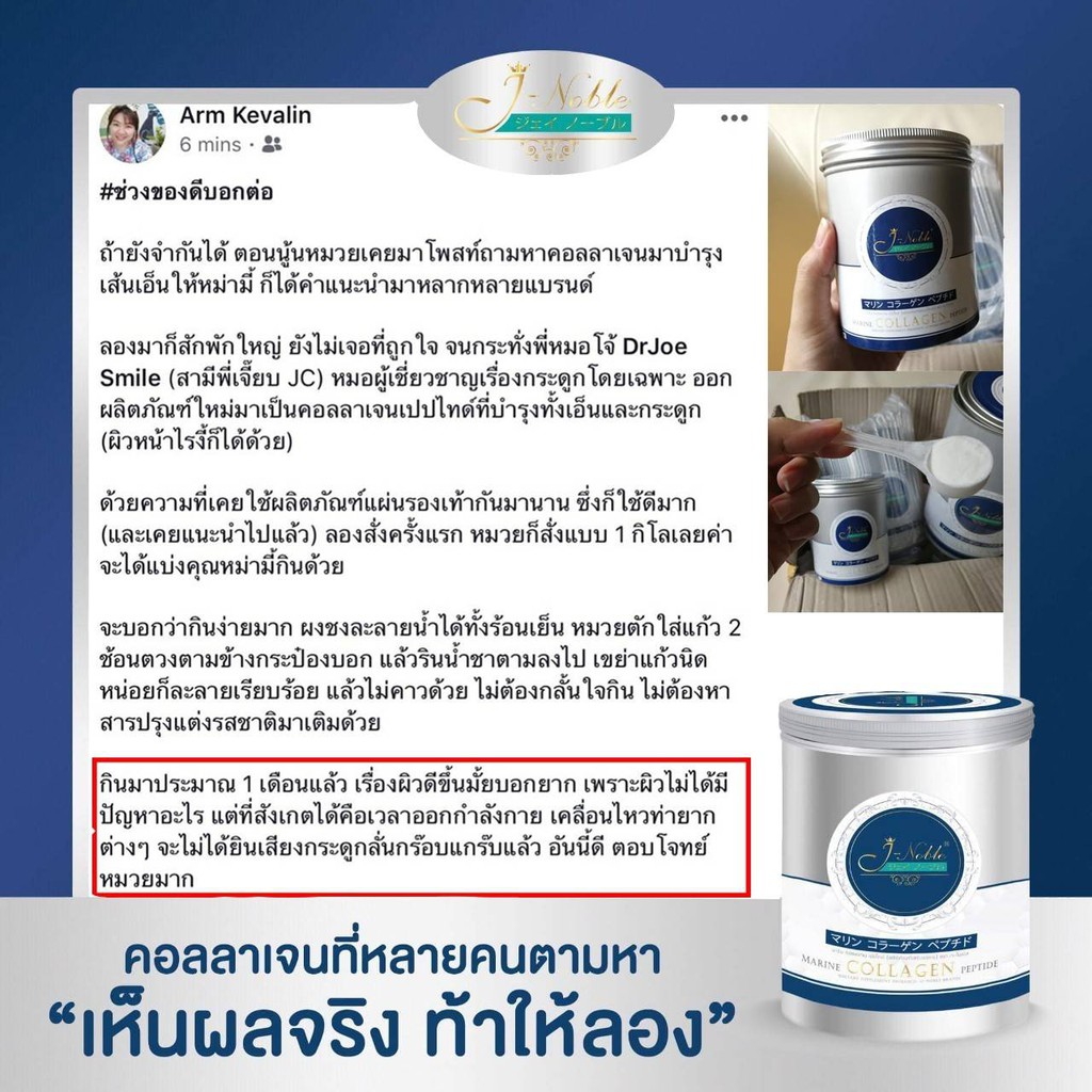 คุณแม่หลังคลอด ไหนจะผมร่วง ไหนจะแคลเซียมที่ต้องการมากกว่าคนปกติถึง 2 เท่าJ-Noble Collagen คอลลาเจน ไ