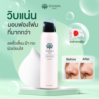 [ 12 ขวด ] Suhada Soda Cleansing Foam ซึฮาดะโซดาคลีนซิ่งโฟม ทำความสะอาดผิวหน้าแบบ 3 in 1