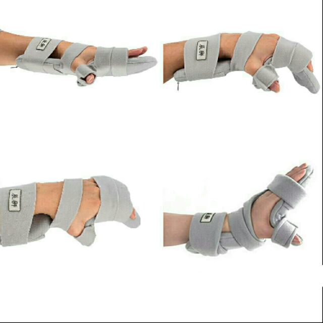 เฝือกมือแบบปรับมุมได้ (Adjustable hand splint)