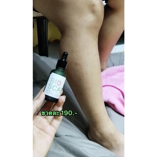 Bioscar ไบโอสการ์เจล ลบรอยแผลเป็น ขาลาย ตุ่ม รอยสิว น้ำเหลืองไม่ดี ผิวแพ้ง่ายใช้ได้ สูตรเข้มข้น สารสกัดจากธรรมชาติ