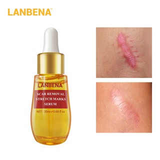 LANBENA รอยแผลเป็นจากสิวลบเซรั่ม Remover เครื่องหมายยืดซ่อมแผลเป็นเครื่องหมายยืดครีมรักษาสิว