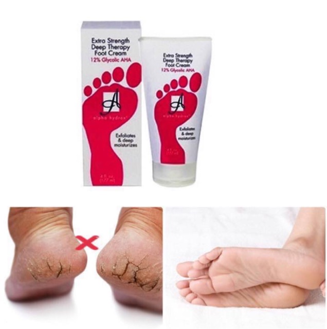 alpha hydrox foot cream