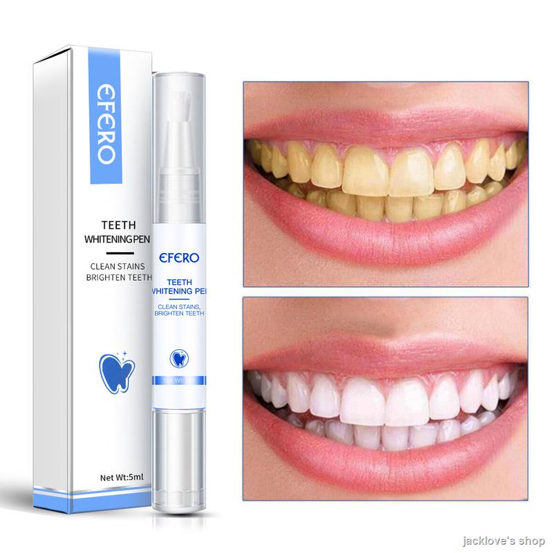 ช่องปากTeeth Whitening en Tooth Gel Cleaning Serum Remove laque Sta