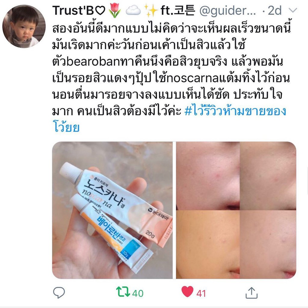 🔥พร้อมส่งแท้💯🔥 베아로반 연고 Blearoban Bearoban Ointment 10G เจลลดรอยแผลเป็น  เกาหลี เจลลดรอยสิว ครีมแก้รอยสิว ครีมลดรอยแผลเป็น | Shopee Thailand