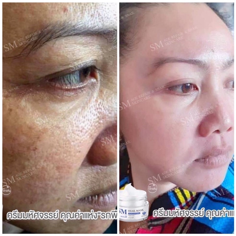 smskincare ลดอย่างแรง!! ของแท้100% ราคายกชุด2กระปุก - รูปที่ 3