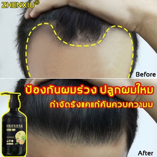 แชมพูขิง 300ml แชมพูแก้ผมร่วง แชมพู ยาสระผมเร่งยาว แชมพูเร่งผมยาว   ยาสระผม แชมพูสระผม ยาสระผมแก้ร่วง shampoo