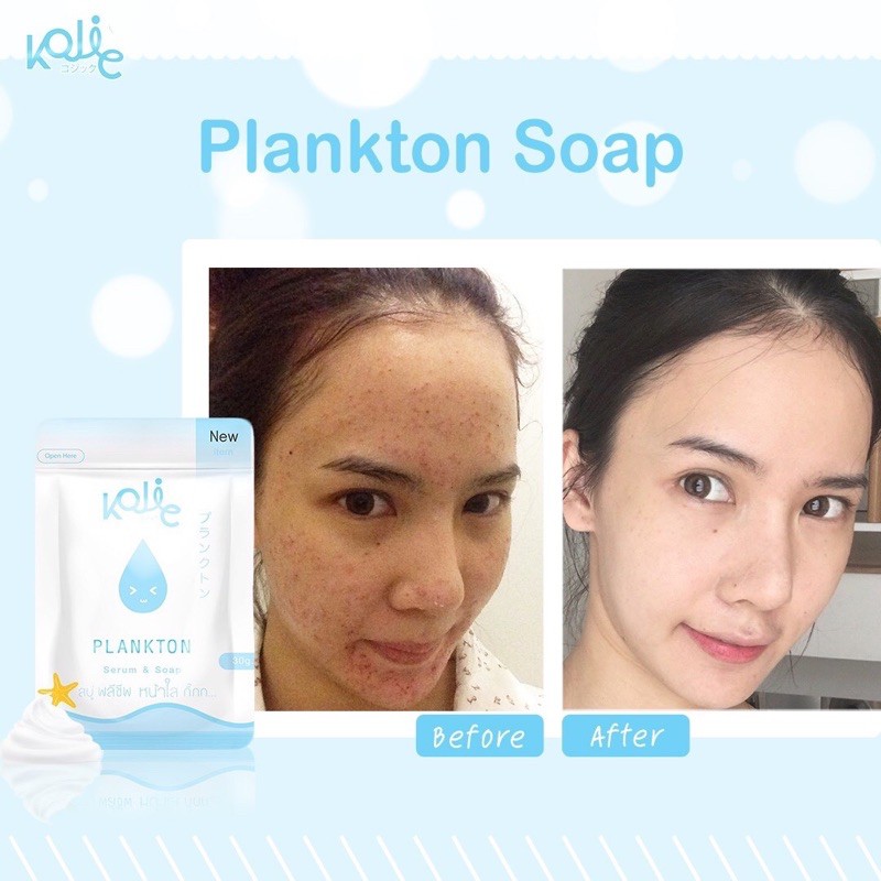 (พร้อมส่ง มีของแถม) สบู่แพลงค์ตอน Plankton Soap แบรนด์Kojic Thailand ลดสิว รอยดำรอยแดง หน้าขาวใส แพ้