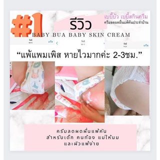 เบบี้บัวสกินครีม ผดผื่นแพ้คัน หายใน1-7 วัน ไม่มีสารเคมีปราศจากสเตียรอยด์